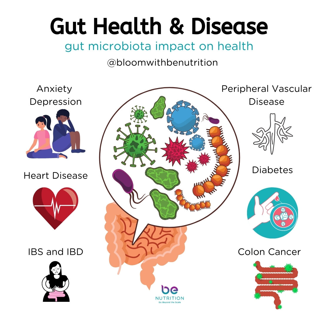 Understanding Why Gut Health Suffers